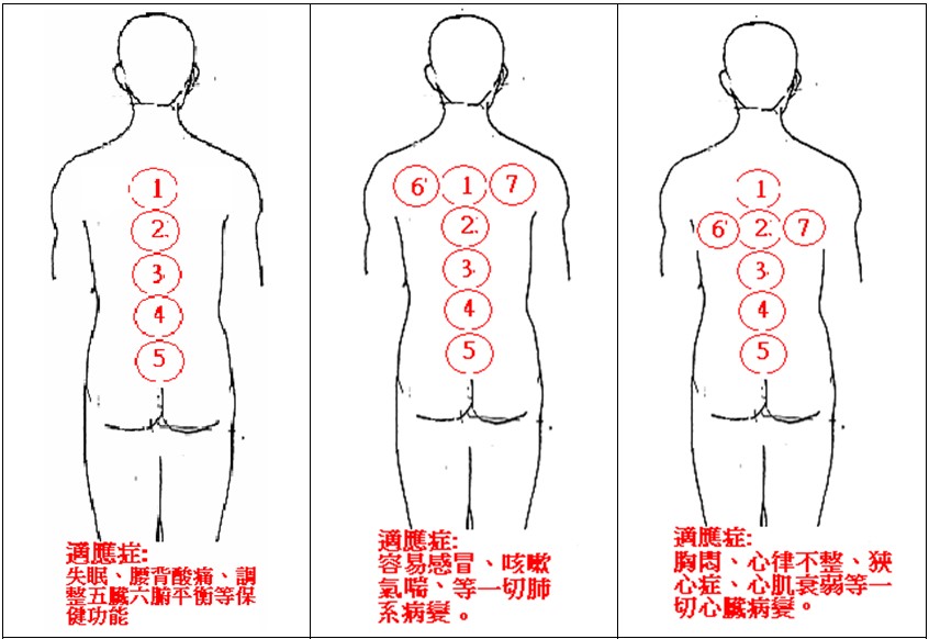 熨法部位十二式3