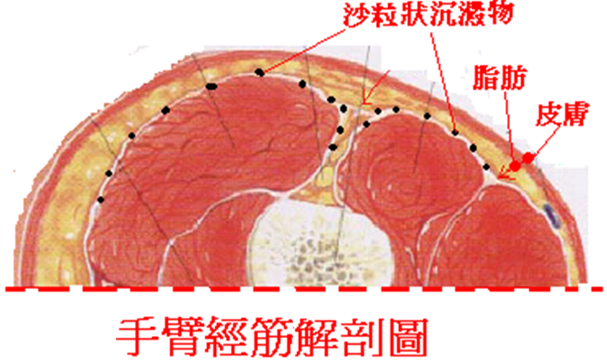 手臂經筋解剖圖